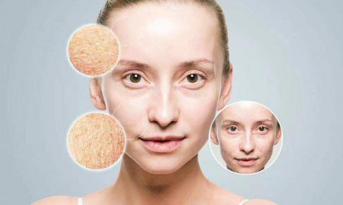 Do you have these skin problems, too?